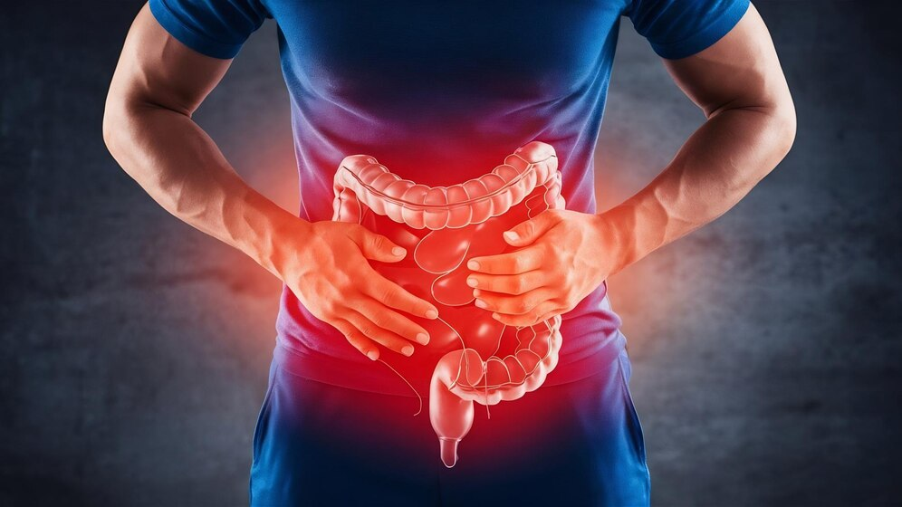 Homeopathy for Gastrointestinal Disorders